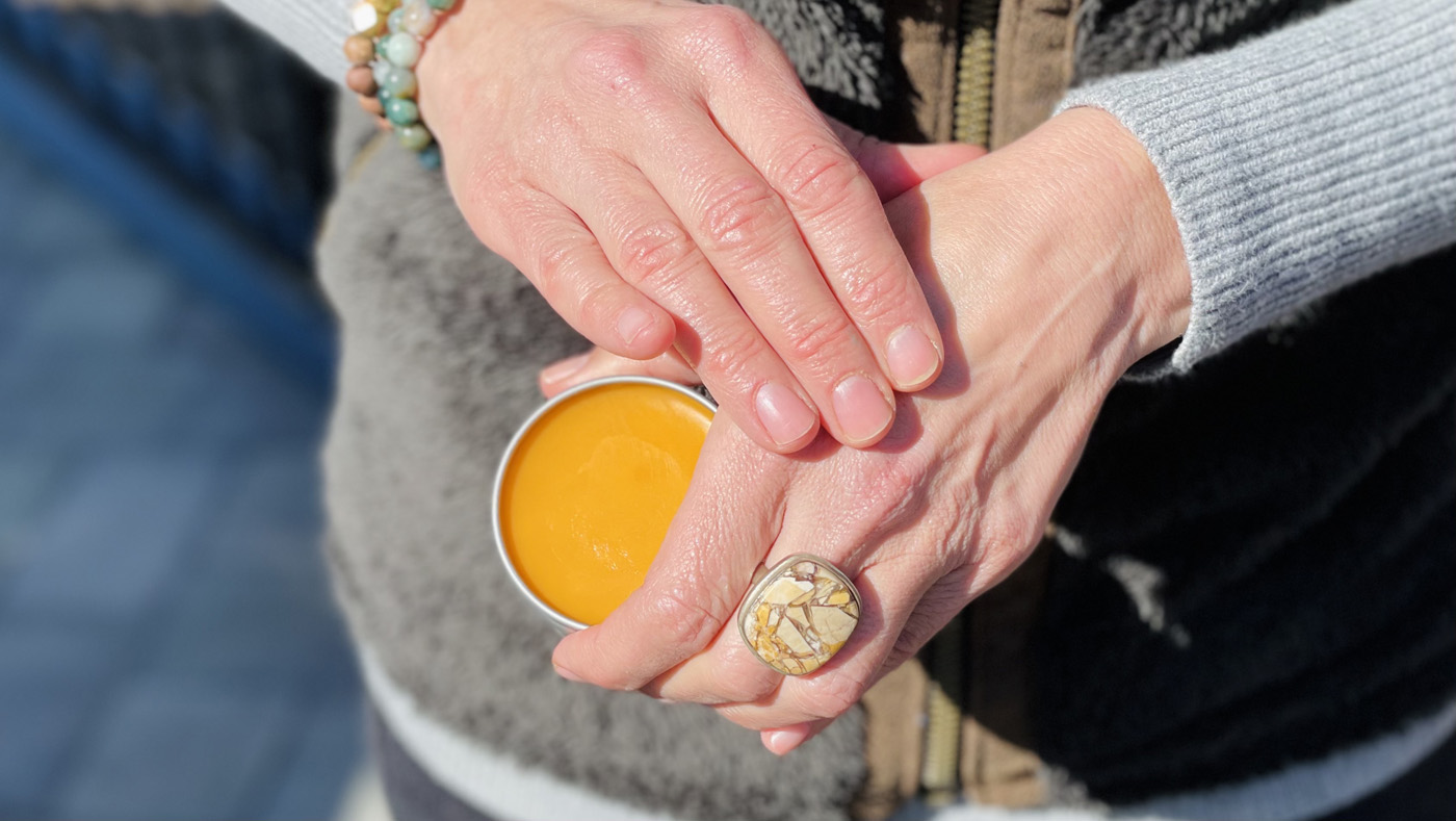 Nicole Apelian using salve on hands to manage multiple sclerosis symptoms