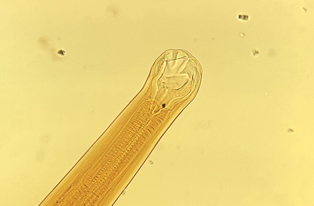 hookworm magnified