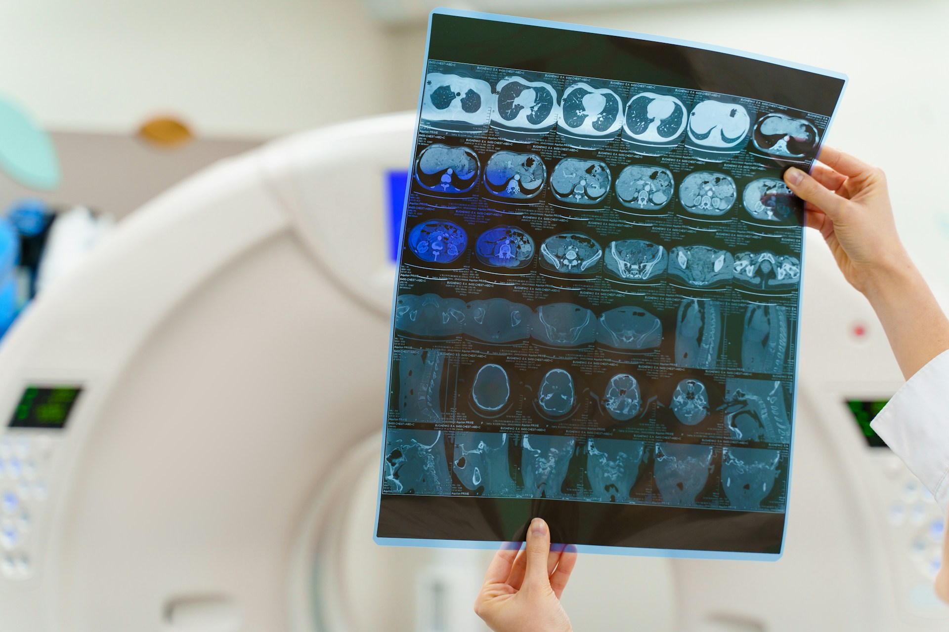 MRI scans MRI scans